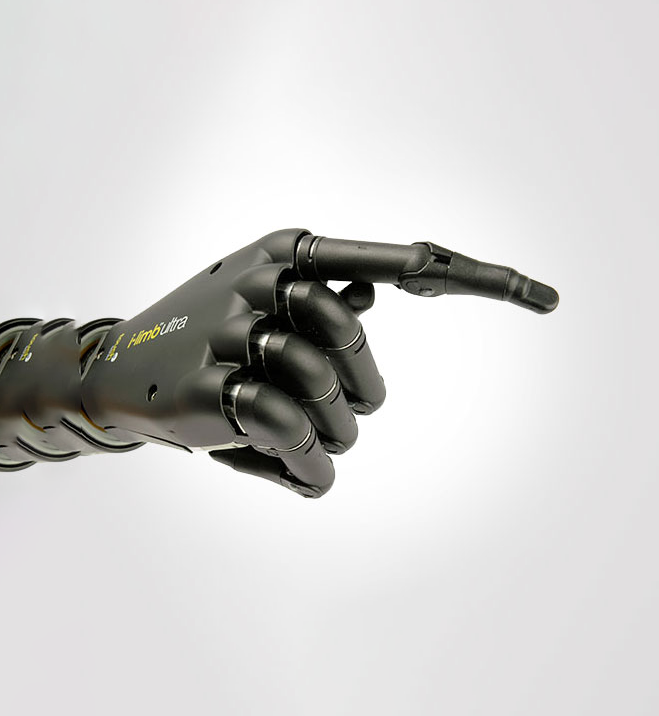 Hand